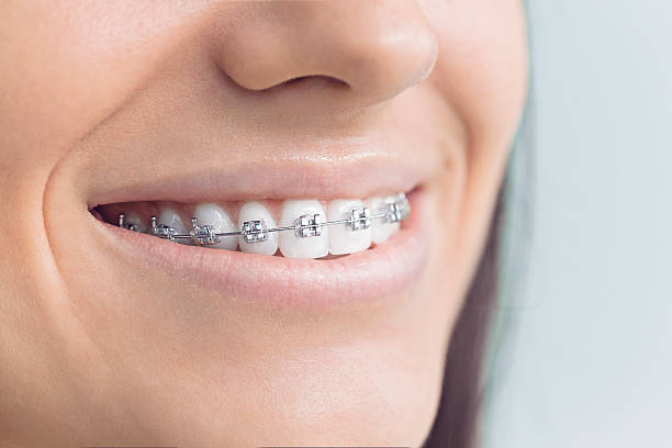 Best Invisalign and Clear Aligners  in Rio Grande, NJ